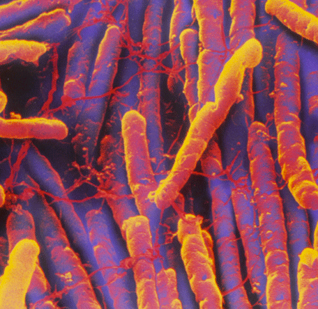 original_Clostridium-difficile_456px